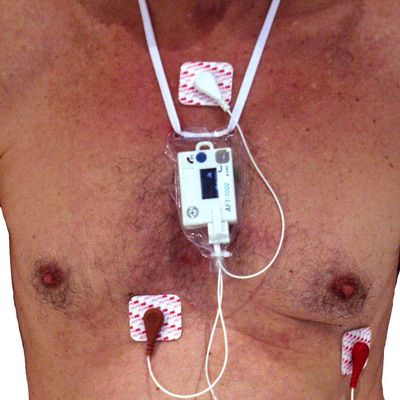 Holter monitor