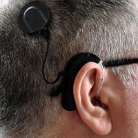 Cochlear implant