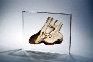 Plastination
