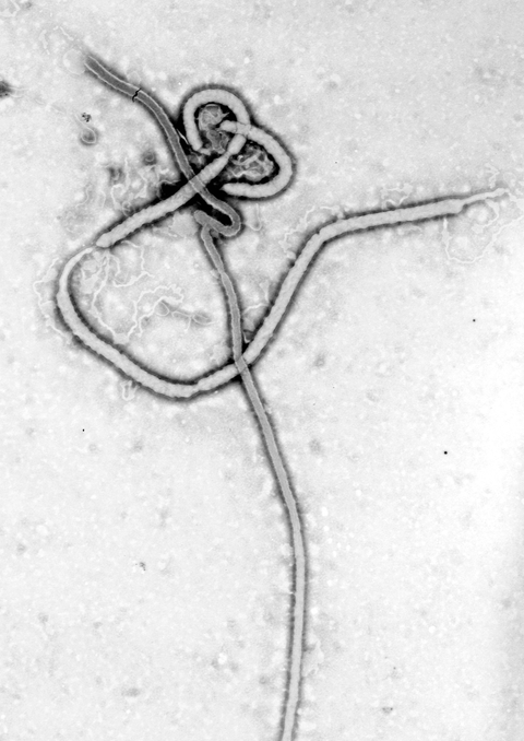 Orthoebolavirus zairense